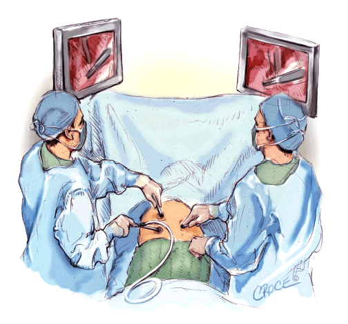 Minimally invasive pulmonary resectxion